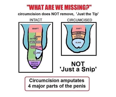 In addition to the predictable physical changes that occur with circumcision, there are inherent risks and potential complications from the surgery. . Uncircumcised male organ